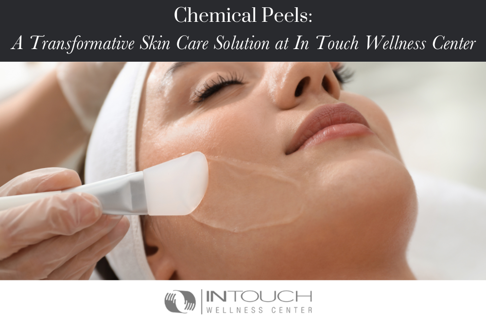 Chemical Peels A Transformative Skin Care Solution at In Touch Wellness Center
